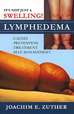 It's Not Just a Swelling! Lymphedema by by Joachim Zuther
